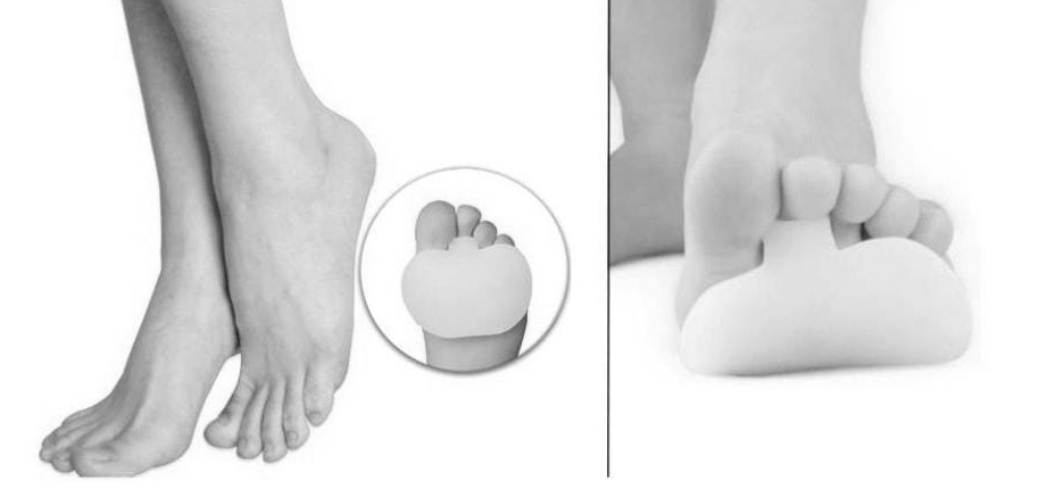 forefoot