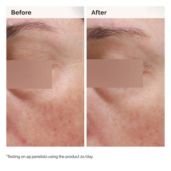 TheOrdinaryNiacinamide5_FaceAndBodyEmulsionForDarkSpotsAndUnevenTone1